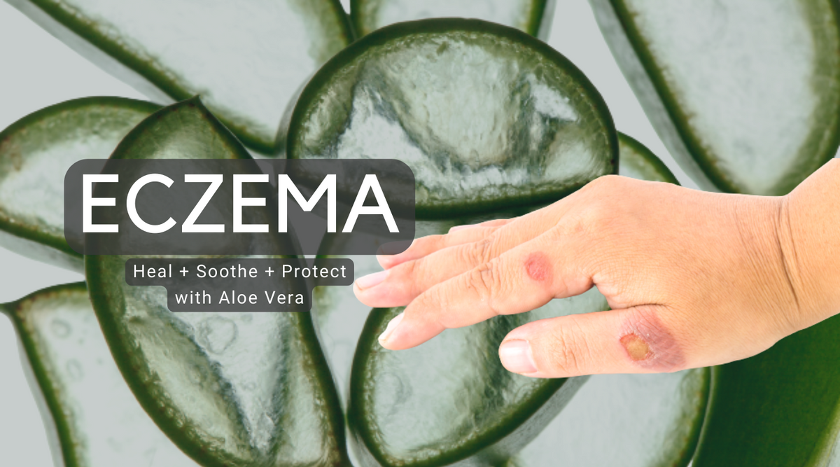 Unlock Aloe Vera's Power: A Natural Eczema Solution & Skin Soother