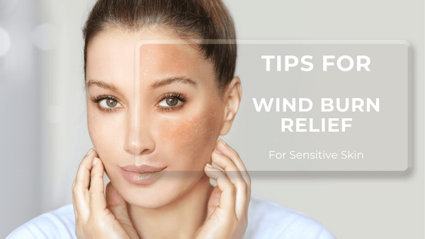 Natural Solutions for Wind Burn: Gentle Solutions for Sensitive Skin